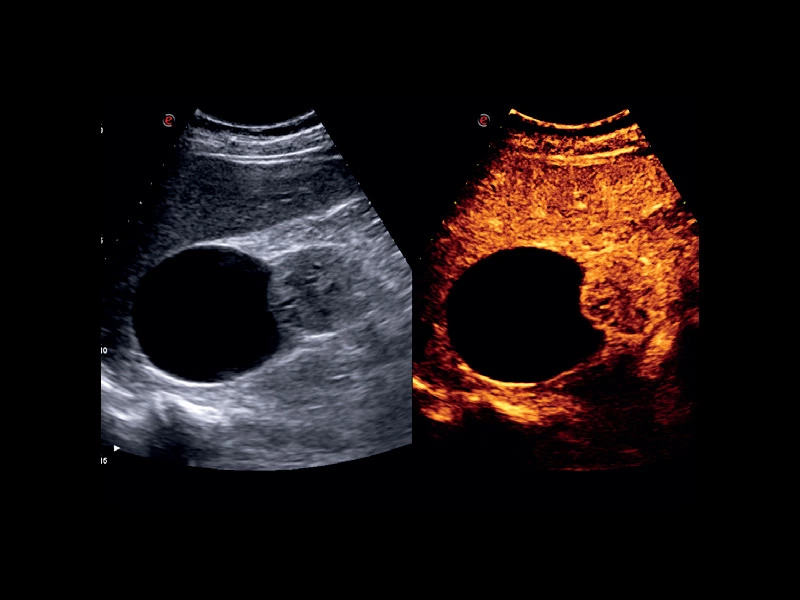 MyLab™X75 - General Imaging 04