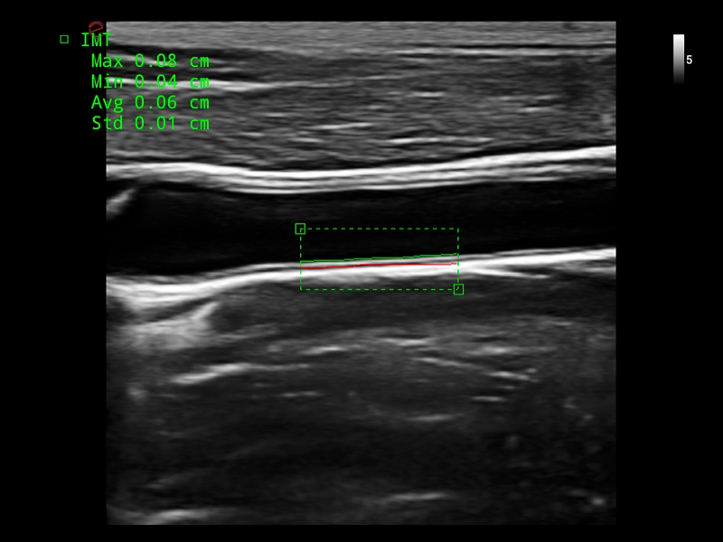 MyLab™X1 Go - General Imaging 08