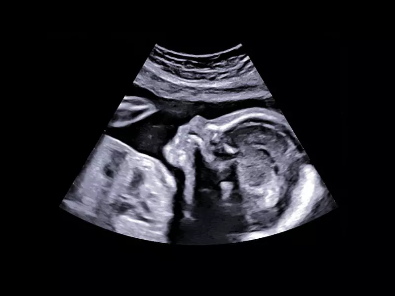 MyLab™X90 - Women's Health 04