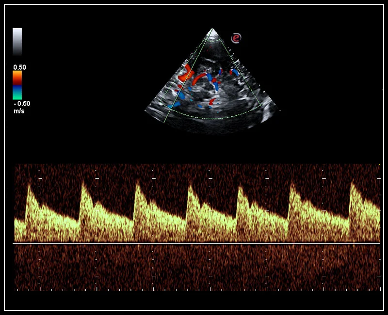 MyLab™Omega - Transcranial doppler