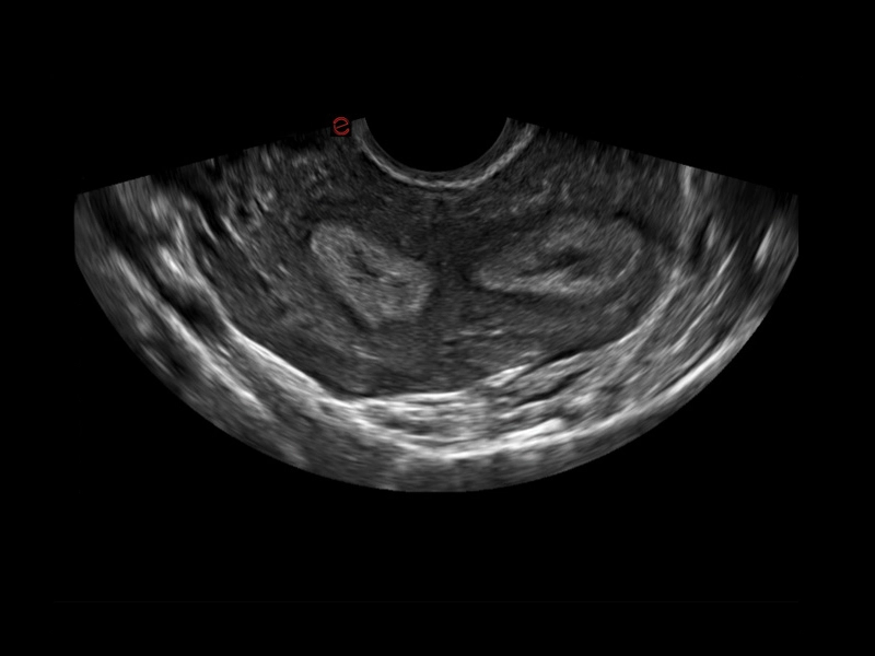 MyLab™X1 Go - General Imaging 06