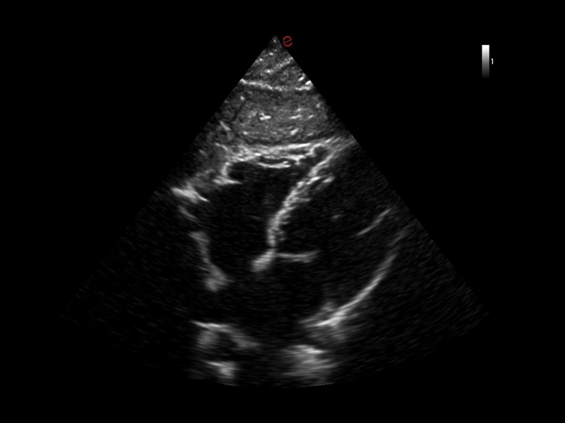 MyLab™X1 Go - General Imaging 07
