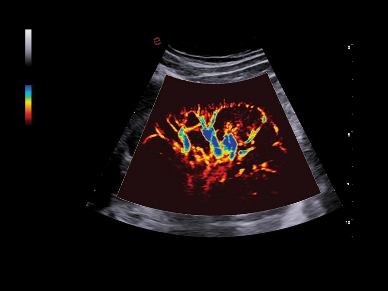 MyLab™A50 - microV kidney