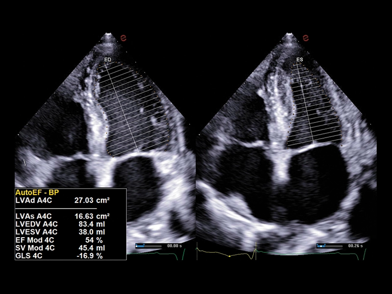 MyLab™A50 - AutoEF