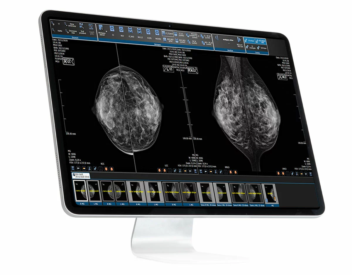 Suitestensa Review, enterprise imaging software