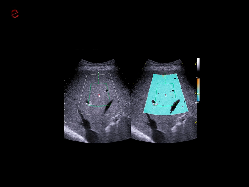 MyLab™C30 - Liver QAI