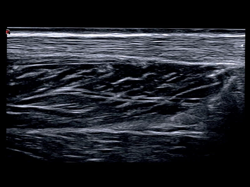 MyLab™X75 - General Imaging 06