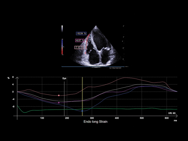 MyLab™A70 - XStrain RV