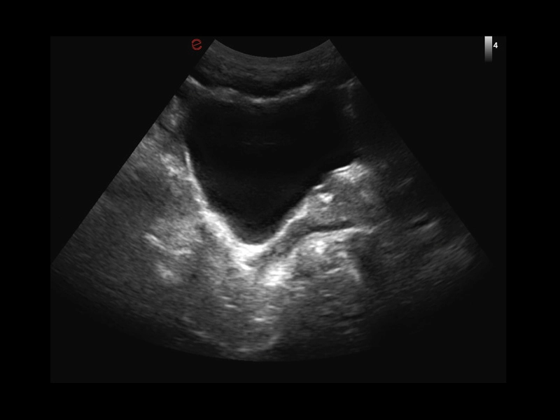 MyLab™X1 Go - General Imaging 05