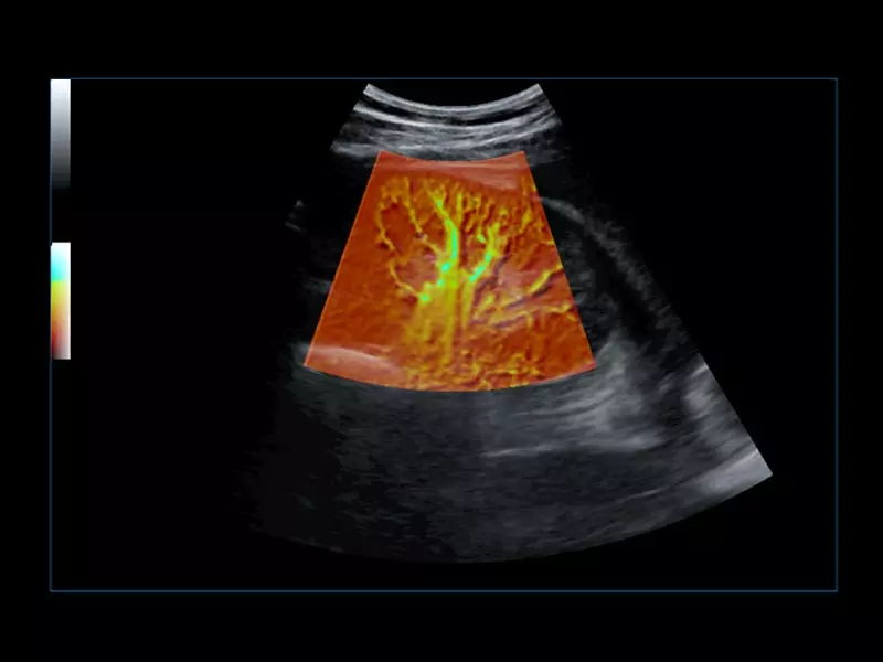 MyLab™Omega eXP - General Imaging 02