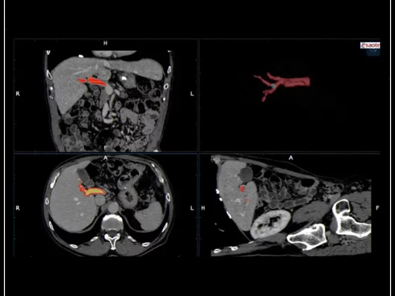 MyLab™9 Platform - Virtual Navigator automatic vascular detection and segmentation with Auto-Fusion