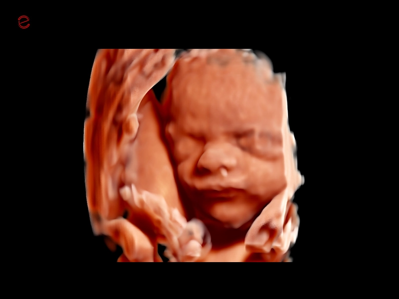 MyLab™C25 - Baby face