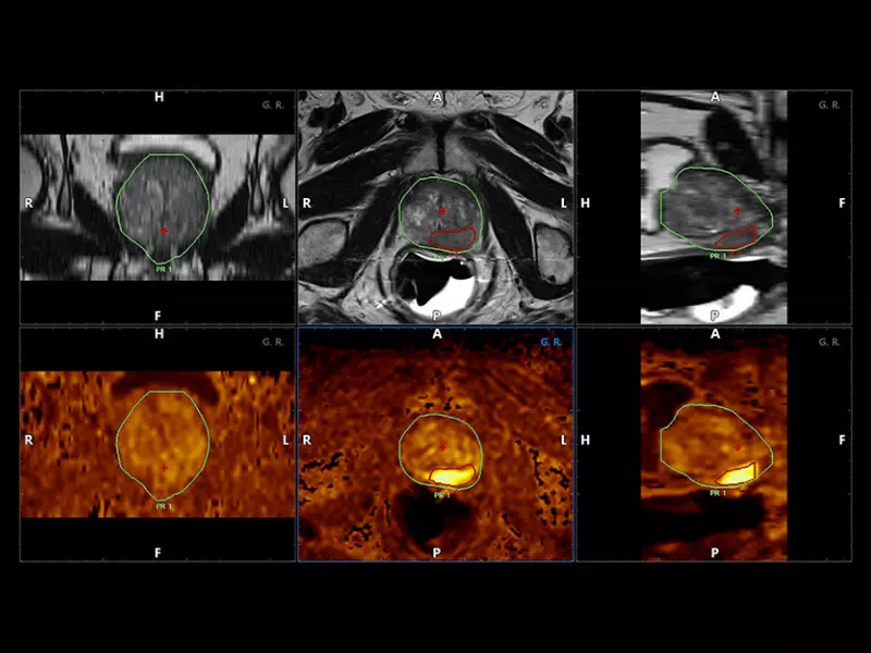 MyLab™X90 - Urology 02