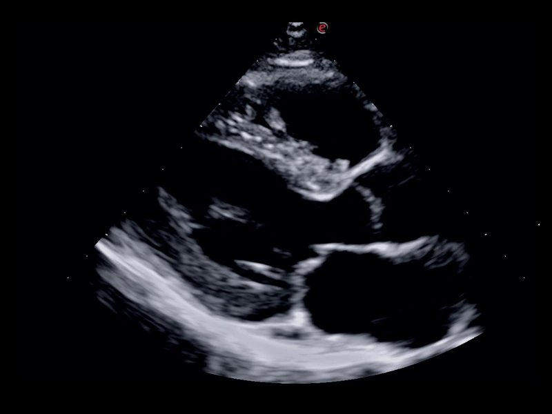 MyLab™X75 - Cardiovascular 06