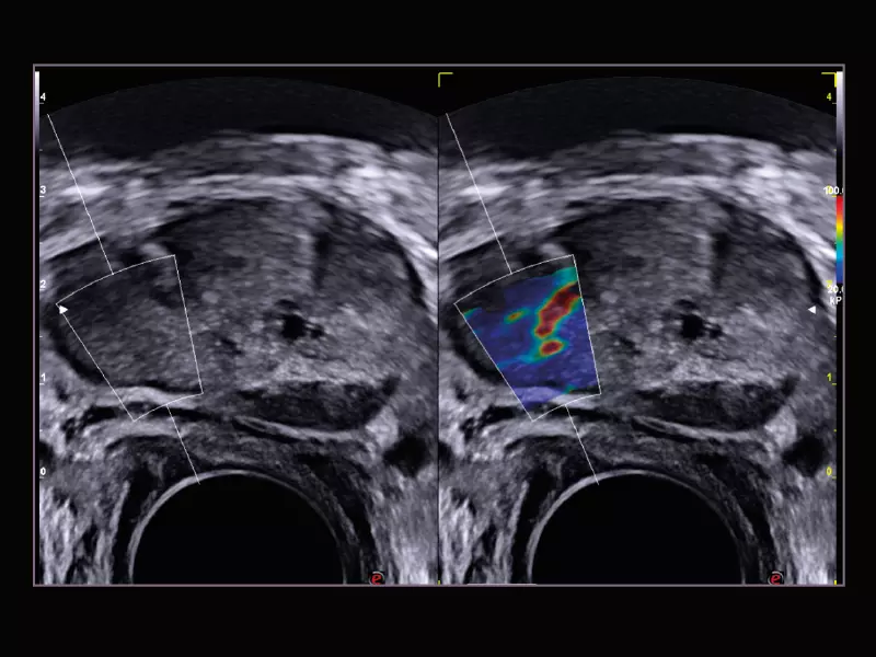 MyLab™X9 - Urology 05