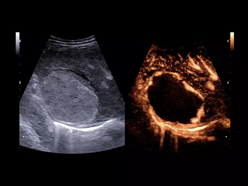 MyLab™X90 - Liver 01