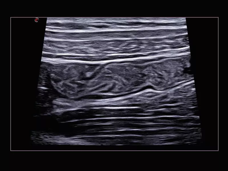 MyLab™X9 - General Imaging 02