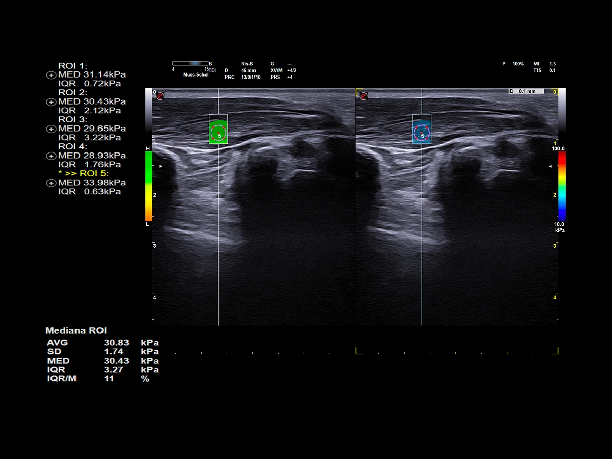 Advanced solutions for Musculoskeletal applications