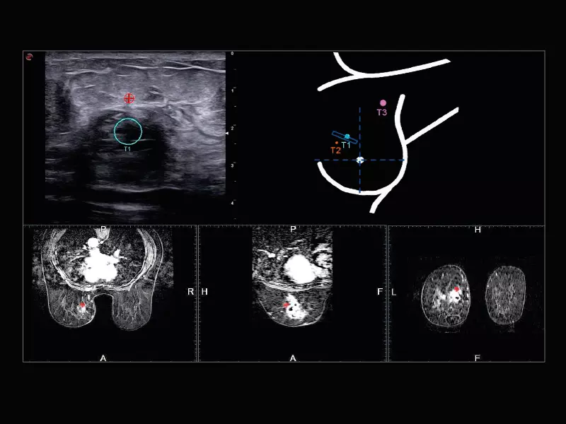 MyLab™X9 - Breast 01