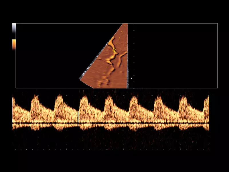 MyLab™X90 - Cardiovascular 06