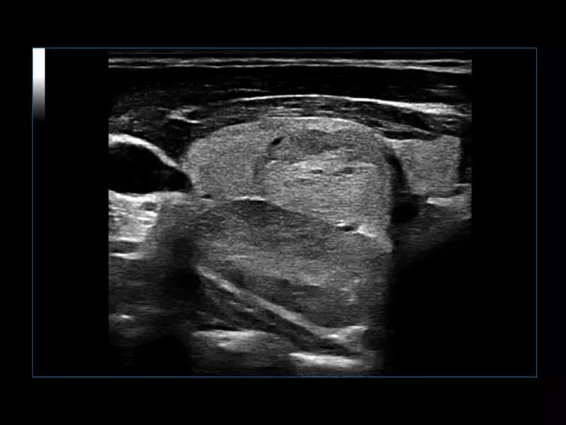 MyLab™Omega eXP - General Imaging 01