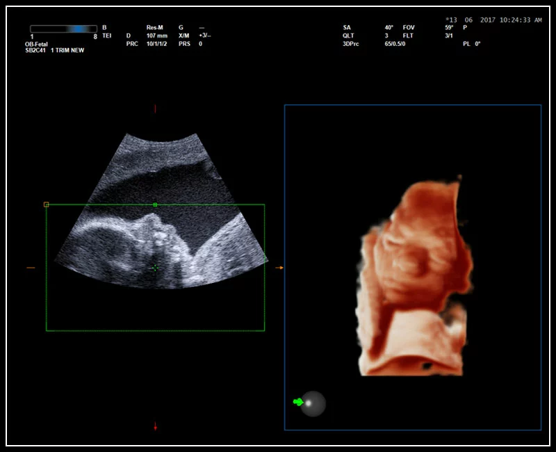 MyLab™9 Platform - Real-time baby face with 4D imaging