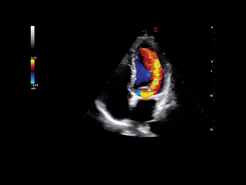 MyLab™A70 - Heart CFM