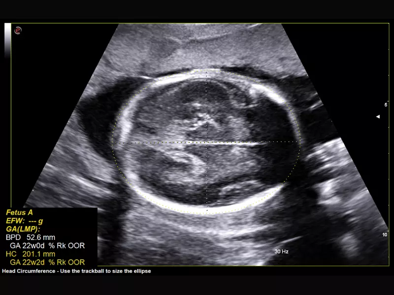 MyLab™Omega eXP - AutoOB