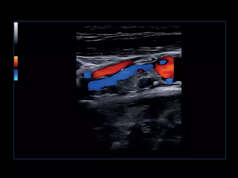 MyLab™Omega eXP - Cardiovascular 02