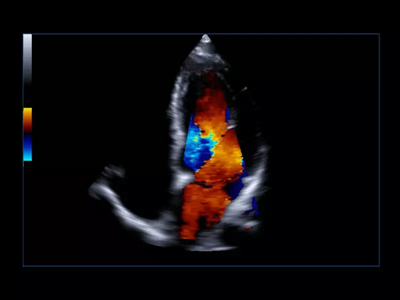 MyLab™Omega eXP - Cardiovascular 01