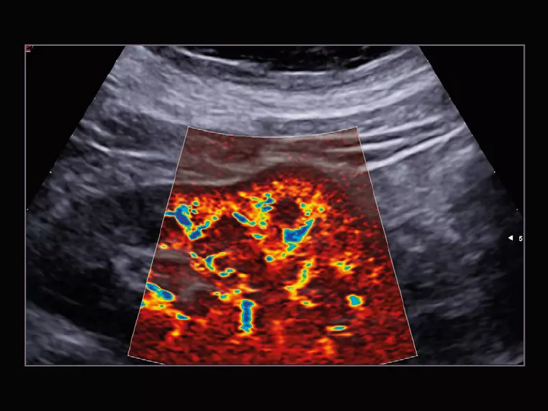 MyLab™X9 - General Imaging 05