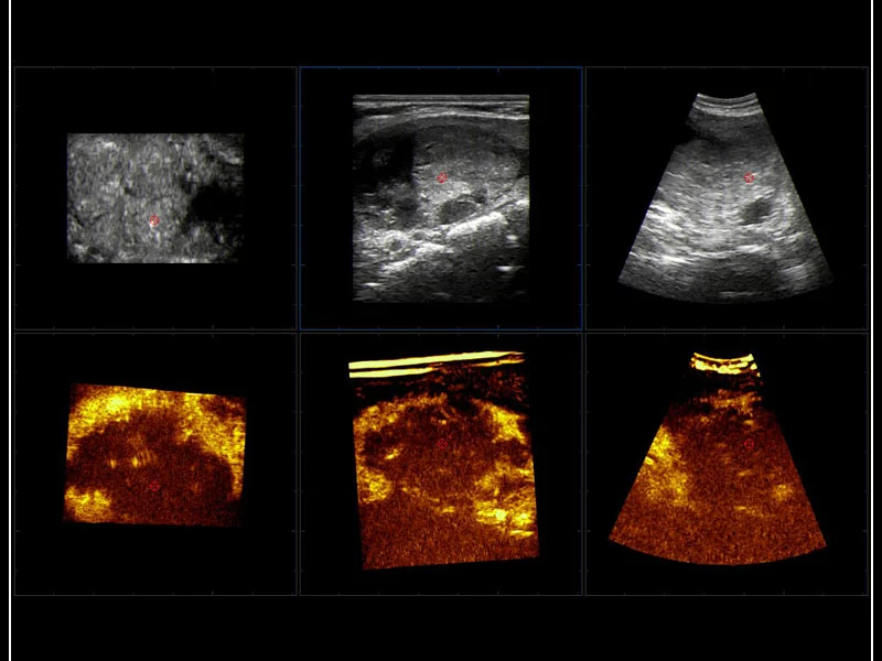 MyLab™9 Platform - Pre-Post volumetric CEUS-multidataset comparison