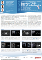 Poster BreastNav<sup>™</sup> MRI: MRI-US fusion imaging