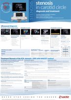 Poster Transcranial Ecocolor Doppler