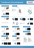 Poster Transthoracic echocardiography