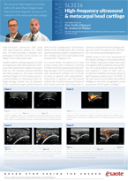 High-frequency ultrasound & metacarpal head cartilage