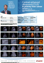 Contrast enhanced ultrasound (CEUS) in primary liver cancer