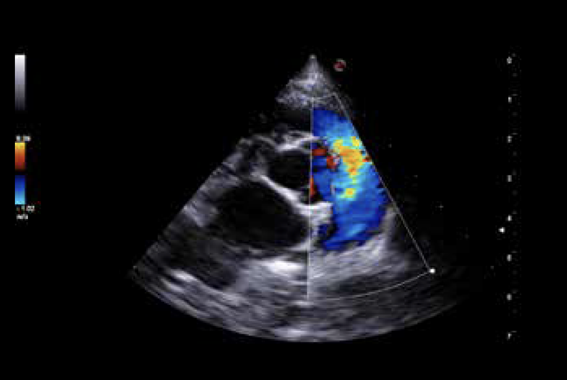 MyLabX75VET Dog - Pulmonary tract outflow - Color Doppler