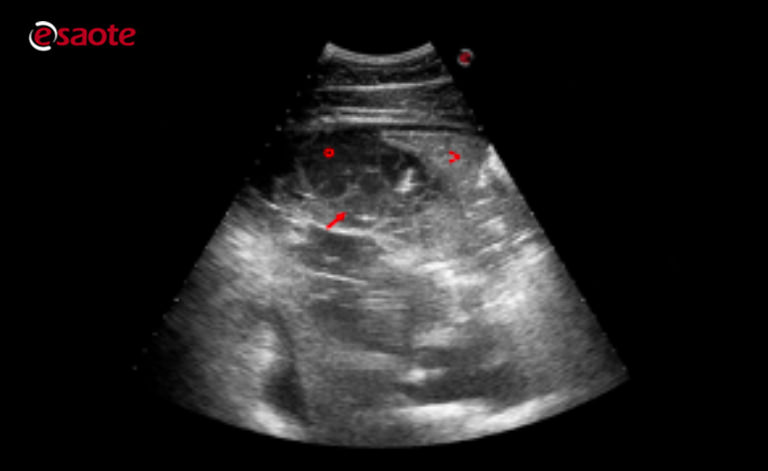 Ultrasound examination
