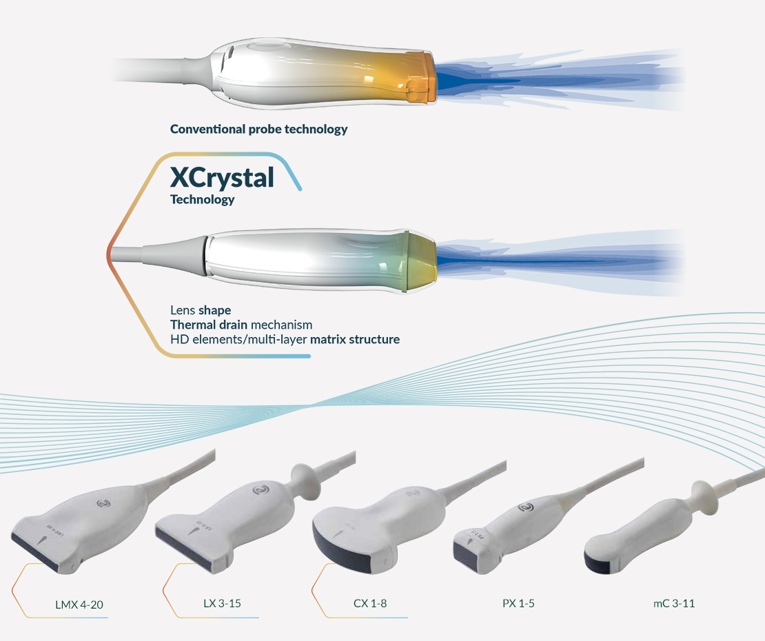MyLab<sup>™</sup>X90VET технология XCrystal