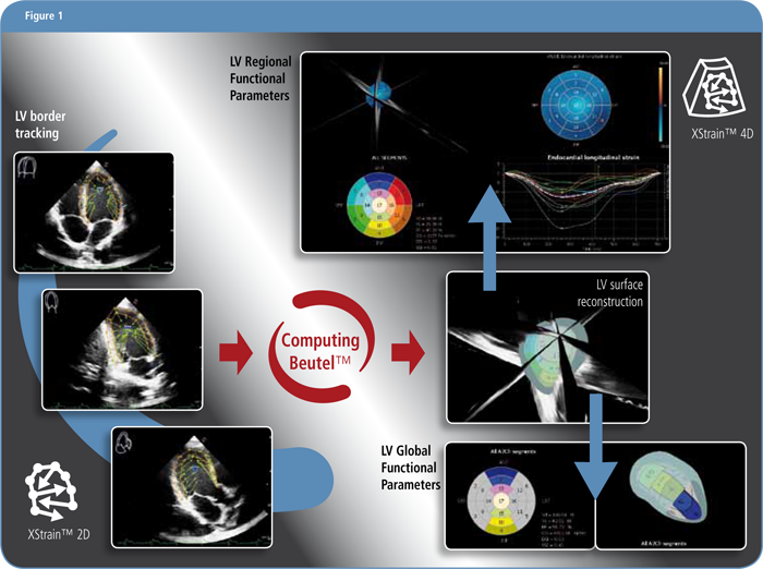 Progression of Left Ventricular Myocardial Dysfunction in Systemic  Sclerosis: A Speckle-tracking Strain Echocardiography Study