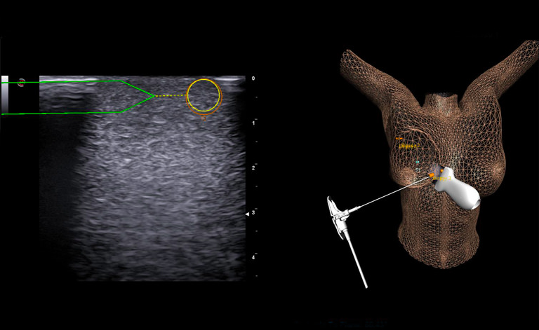 Real-time tracking of the needle and the probe during biopsy procedures