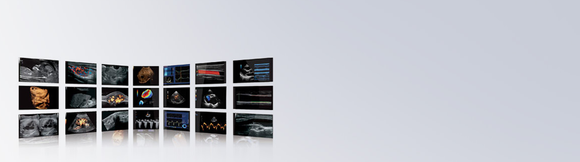 Esaote Ultrasound Additional Systems