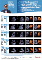 Contrast enhanced ultrasound (CEUS) in benigne liver lesions