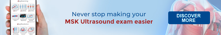 Never stop making your MSK ultrasound exam easier!