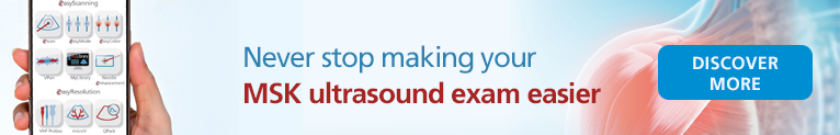 Never stop making your MSK ultrasound exam easier!