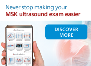 Never stop making your MSK ultrasound exam easier!