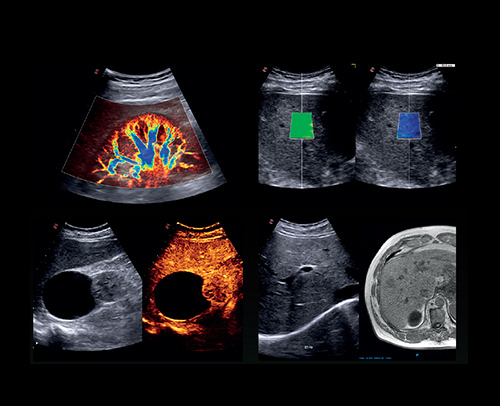 Comprehensive Liver Assessment