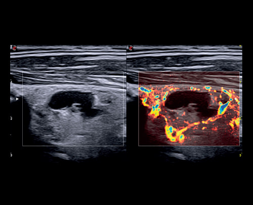 Clinical Excellence in Vascularization Imaging