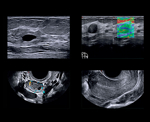 High-frequency Imaging for Breast and Gynaecology - Dedicated Tools in Reproductive Medicine